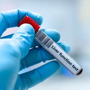 Liver Functions Test – LFT