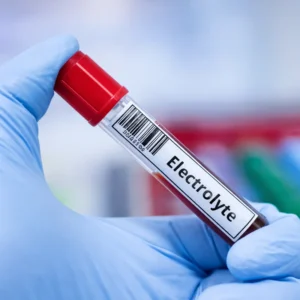 Electrolytes (Serum) Test