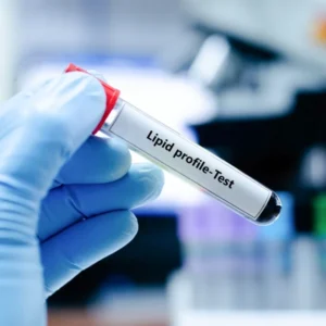 Lipid Profile Test