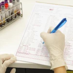 Random Blood Sugar (RBS) Test