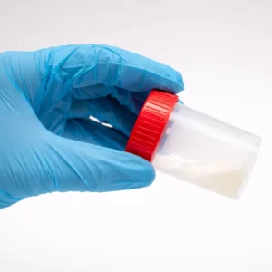 Semen Analysis Test