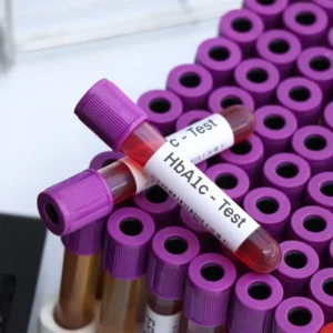 HbA1c Test (Glycosylated Hb)