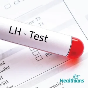LH (Luteinizing hormone)