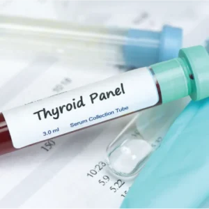 THYROID PROFILE (T3, T4, TSH)