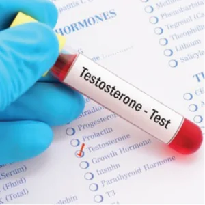 Testosterone (Serum)
