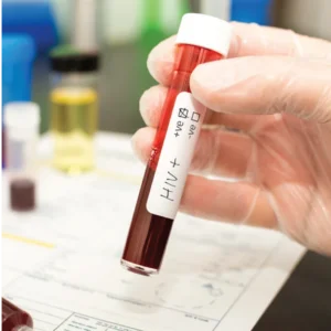 HIV