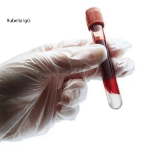 Rubella IgG