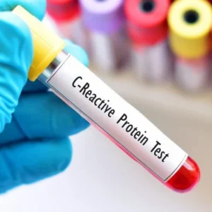 CRP (C-Reactive Protein)