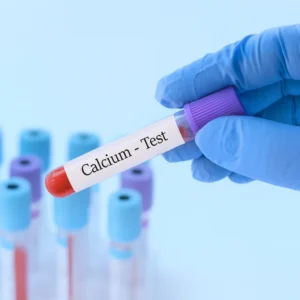 Calcium Test (Serum)