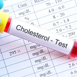Cholesterol