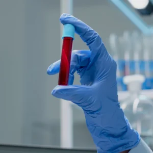 Low density lipids (LDL)