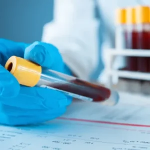 Cortisol Test (PM)