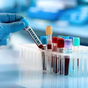 Amylase