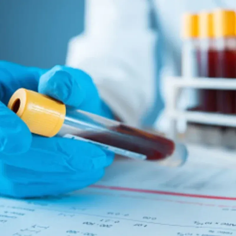 Ear Swab for Bacterial C/S