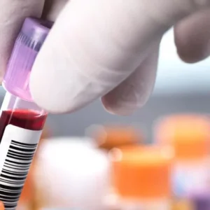HCV Genotyping By PCR