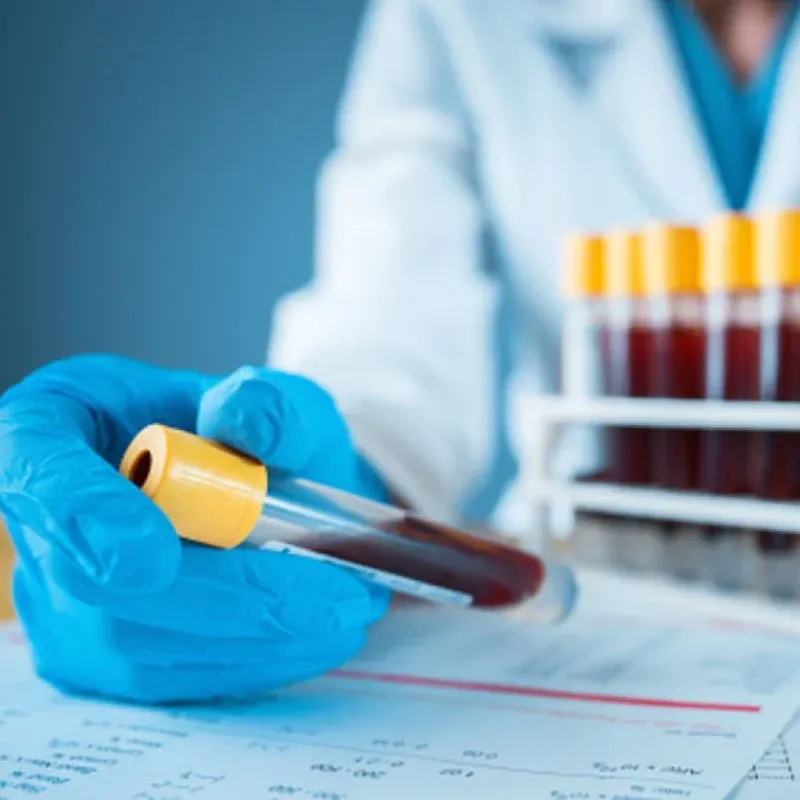 Insulin-like Growth Factor-1 (IGF-1)