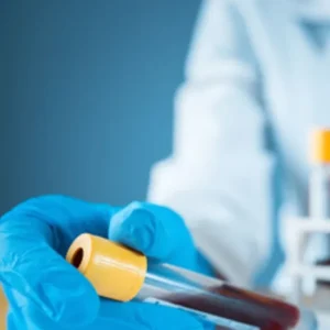 Valproic Acid Test (Epival)