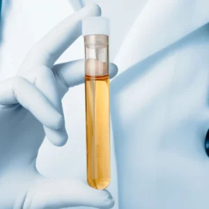Urinary Creatinine (Spot)